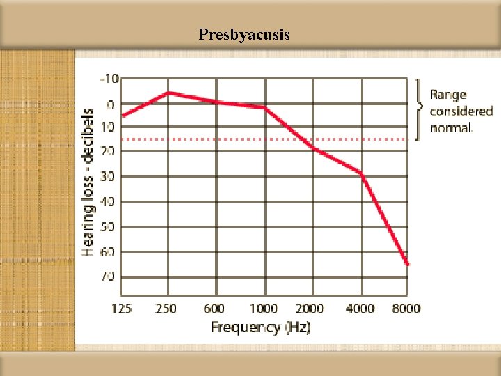 Presbyacusis 