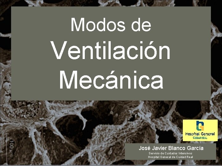 Modos de Ventilación Mecánica José Javier Blanco García Servicio de Cuidados Intensivos Hospital General