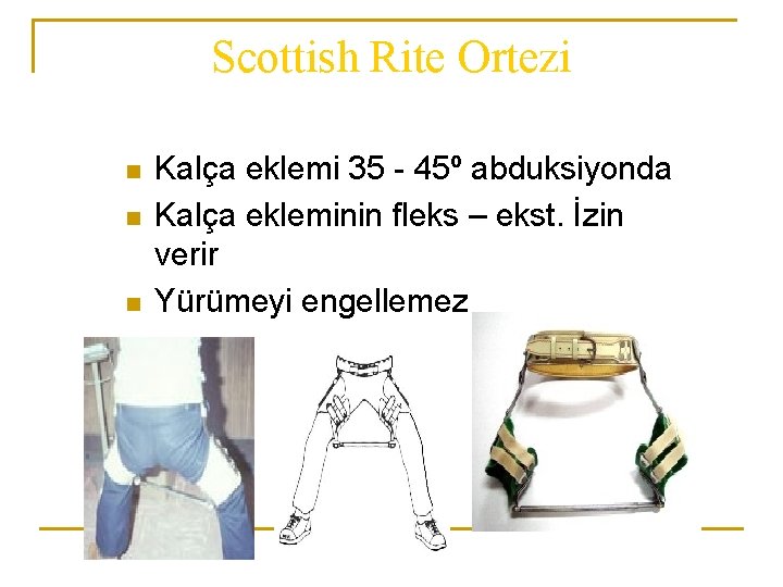 Scottish Rite Ortezi n n n Kalça eklemi 35 - 45º abduksiyonda Kalça ekleminin