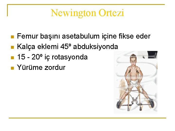 Newington Ortezi n n Femur başını asetabulum içine fikse eder Kalça eklemi 45º abduksiyonda