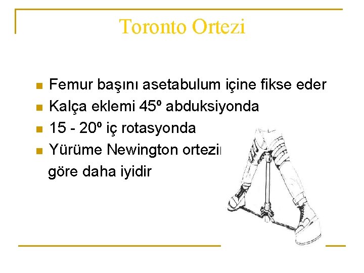 Toronto Ortezi n n Femur başını asetabulum içine fikse eder Kalça eklemi 45º abduksiyonda