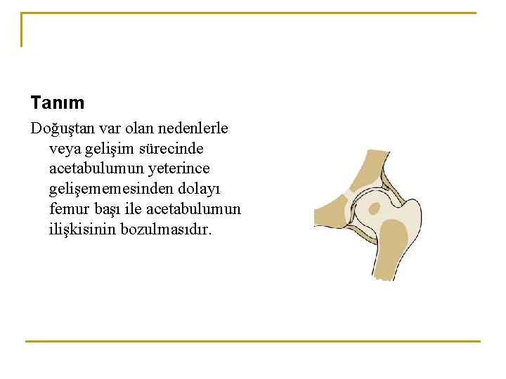 Tanım Doğuştan var olan nedenlerle veya gelişim sürecinde acetabulumun yeterince gelişememesinden dolayı femur başı