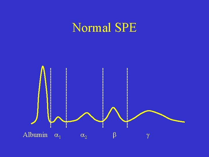 Normal SPE Albumin 1 2 