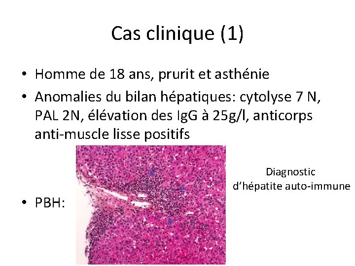 Cas clinique (1) • Homme de 18 ans, prurit et asthénie • Anomalies du