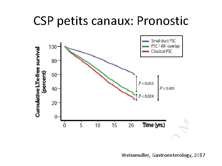 CSP petits canaux: Pronostic Weissmuller, Gastroenterology, 2017 