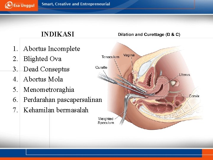 INDIKASI 1. 2. 3. 4. 5. 6. 7. Abortus Incomplete Blighted Ova Dead Conseptus