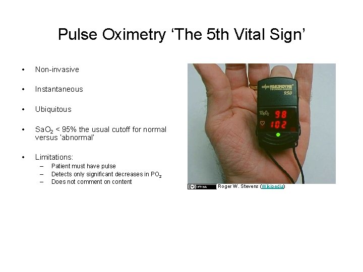 Pulse Oximetry ‘The 5 th Vital Sign’ • Non-invasive • Instantaneous • Ubiquitous •