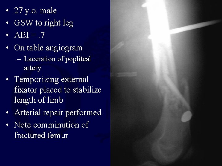 • • 27 y. o. male GSW to right leg ABI =. 7 • • 27 y. o. male GSW to right leg ABI =. 7