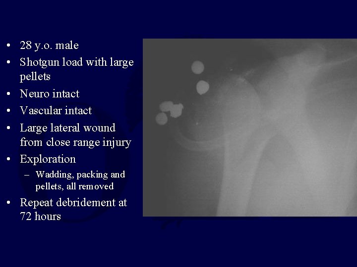 • 28 y. o. male • Shotgun load with large pellets • Neuro • 28 y. o. male • Shotgun load with large pellets • Neuro
