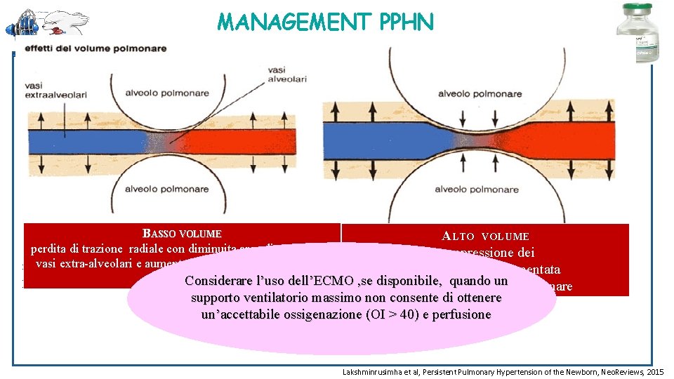 MANAGEMENT PPHN Ventilazione e Surfactante • RECLUTAMENTO POLMONARE OTTIMALE - Sia sotto che sovra