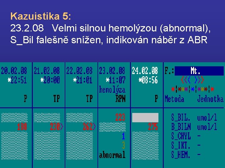 Kazuistika 5: 23. 2. 08 Velmi silnou hemolýzou (abnormal), S_Bil falešně snížen, indikován náběr