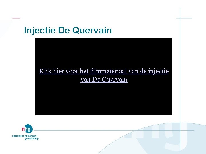 Injectie De Quervain Klik hier voor het filmmateriaal van de injectie van De Quervain