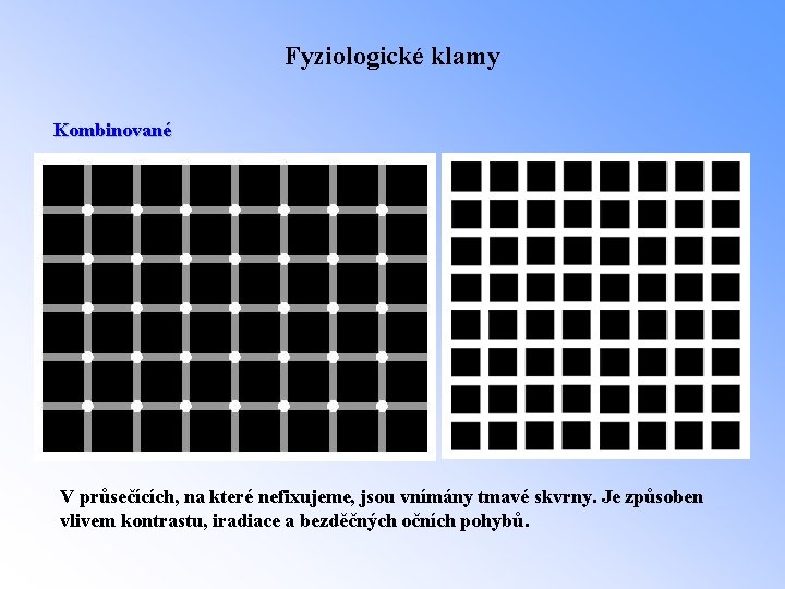 Fyziologické klamy Kombinované V průsečících, na které nefixujeme, jsou vnímány tmavé skvrny. Je způsoben