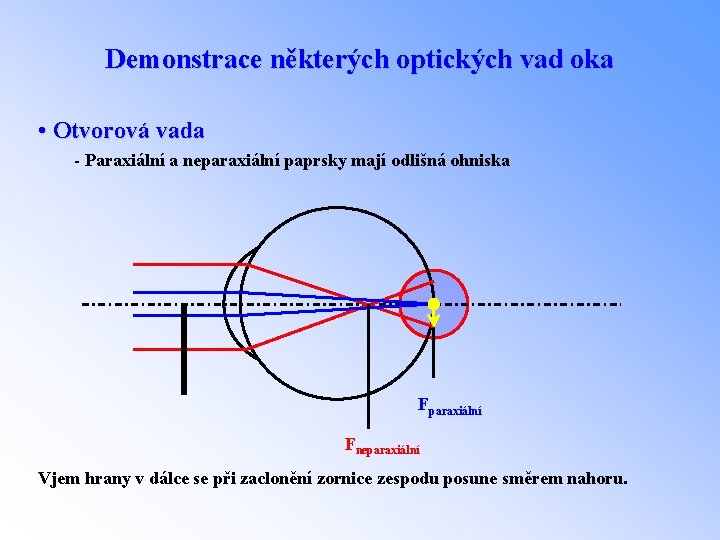 Demonstrace některých optických vad oka • Otvorová vada - Paraxiální a neparaxiální paprsky mají