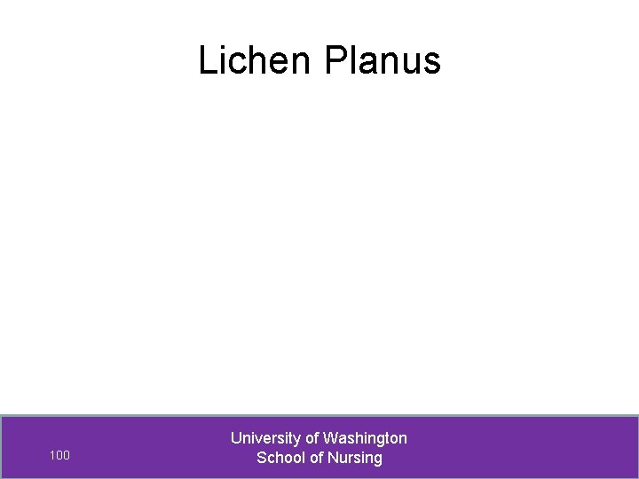 Lichen Planus 100 University of Washington School of Nursing 