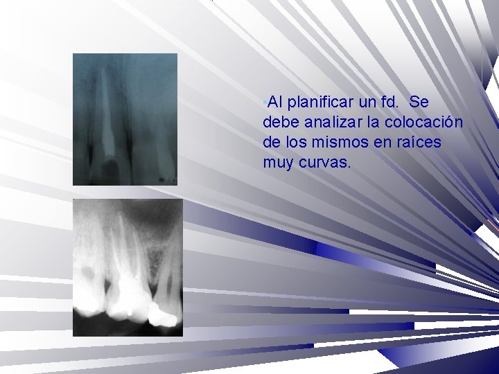  • Al planificar un fd. Se debe analizar la colocación de los mismos