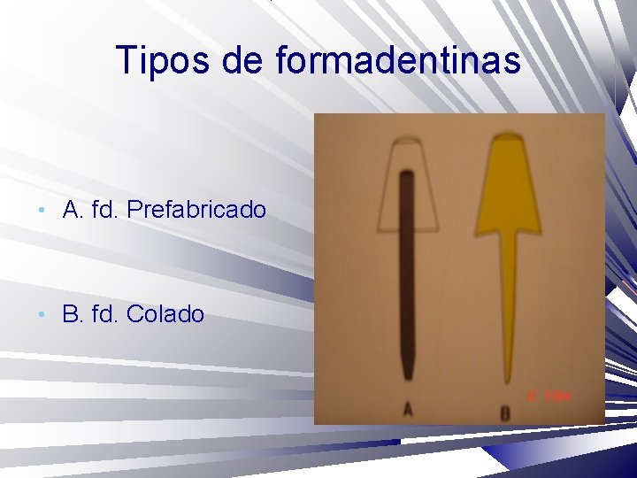 Tipos de formadentinas • A. fd. Prefabricado • B. fd. Colado 