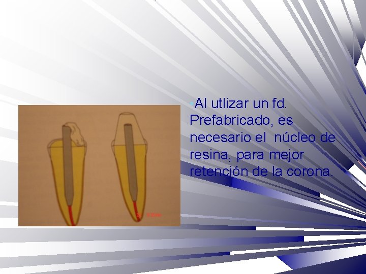  • Al utlizar un fd. Prefabricado, es necesario el núcleo de resina, para
