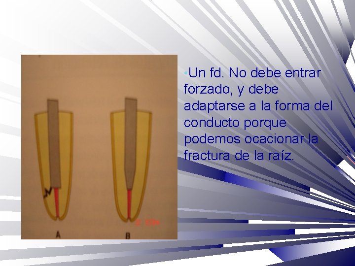  • Un fd. No debe entrar forzado, y debe adaptarse a la forma