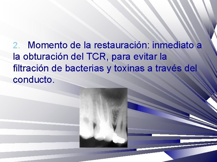 2. Momento de la restauración: inmediato a la obturación del TCR, para evitar la