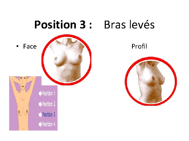 Position 3 : Bras levés • Face Profil 