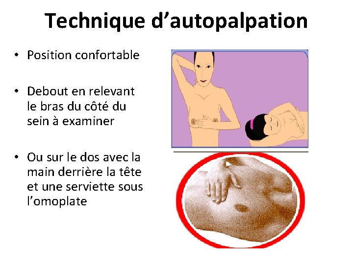 Technique d’autopalpation • Position confortable • Debout en relevant le bras du côté du