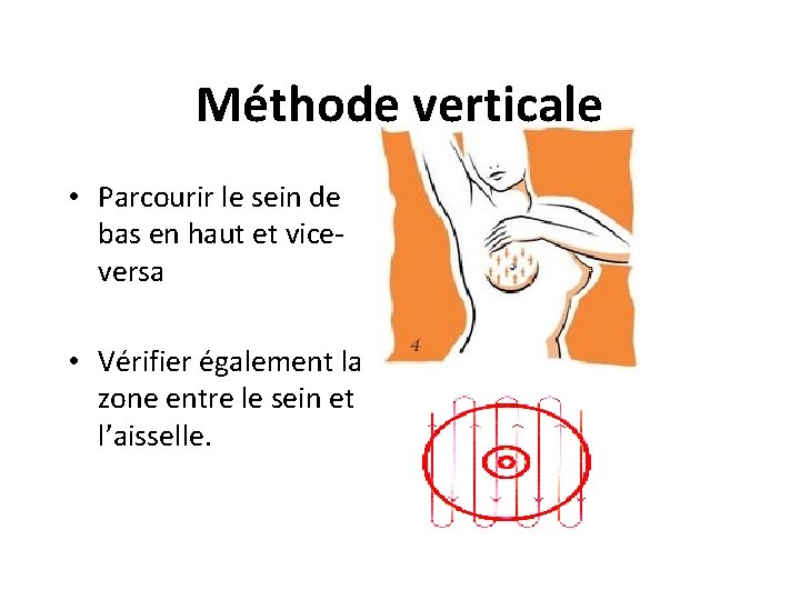 Méthode verticale • Parcourir le sein de bas en haut et viceversa • Vérifier