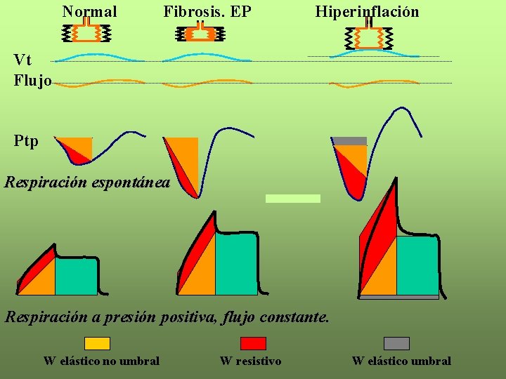 Normal Fibrosis. EP Hiperinflación Vt Flujo Ptp Respiración espontánea Respiración a presión positiva, flujo