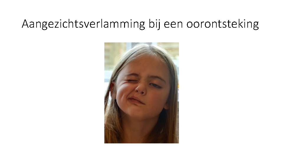 Aangezichtsverlamming bij een oorontsteking Aangezichtsverlamming bij een oorontsteking