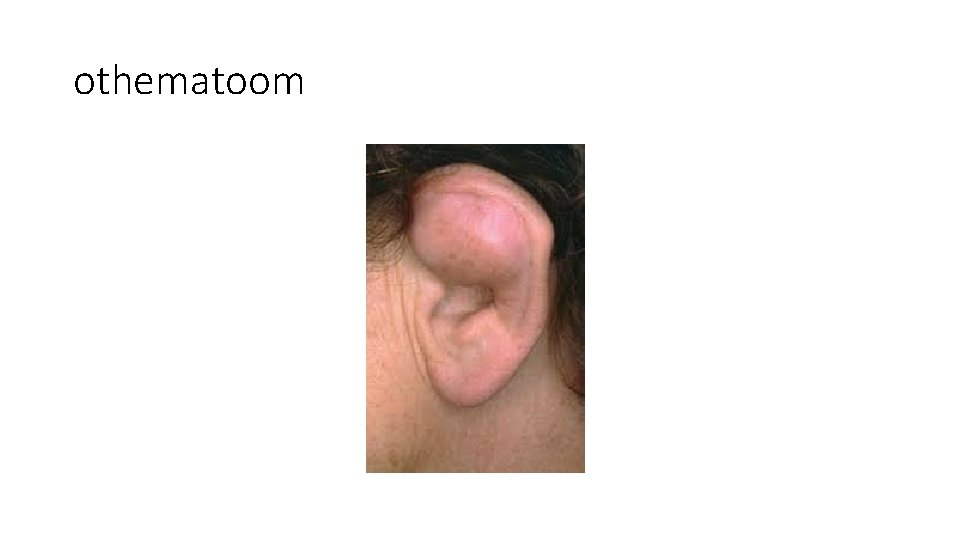 othematoom othematoom