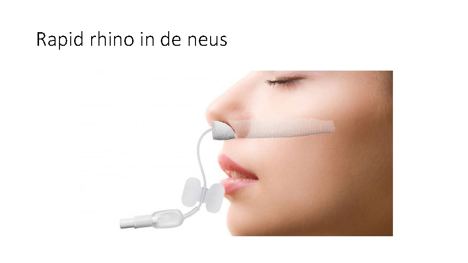 Rapid rhino in de neus Rapid rhino in de neus