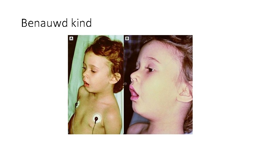 Benauwd kind Benauwd kind