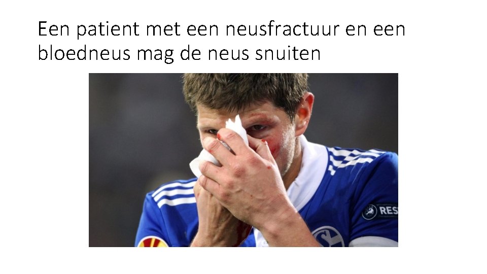 Een patient met een neusfractuur en een bloedneus mag de neus snuiten Een patient met een neusfractuur en een bloedneus mag de neus snuiten