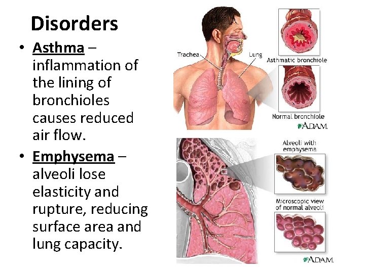 Disorders • Asthma – inflammation of the lining of bronchioles causes reduced air flow.