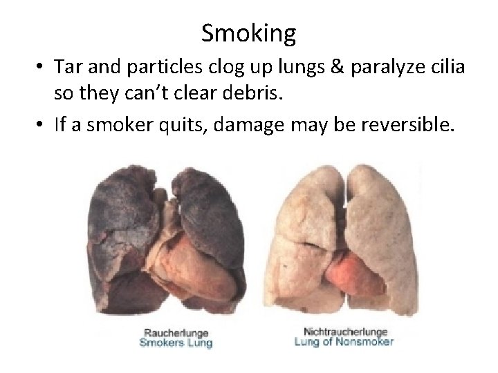 Smoking • Tar and particles clog up lungs & paralyze cilia so they can’t