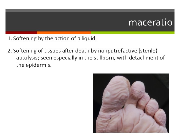 maceratio 1. Softening by the action of a liquid. 2. Softening of tissues after