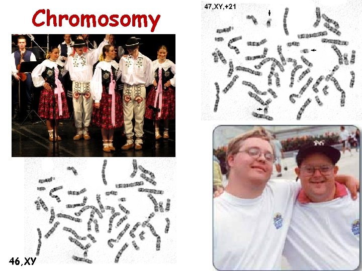 Chromosomy 46, XY 
