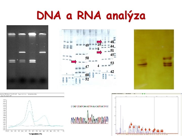 DNA a RNA analýza 49 19 8 50 47 60 52 4 48 44