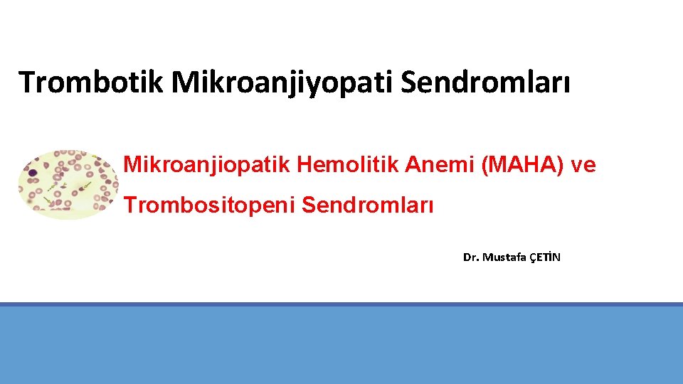 Trombotik Mikroanjiyopati Sendromları Mikroanjiopatik Hemolitik Anemi (MAHA) ve Trombositopeni Sendromları Dr. Mustafa ÇETİN 