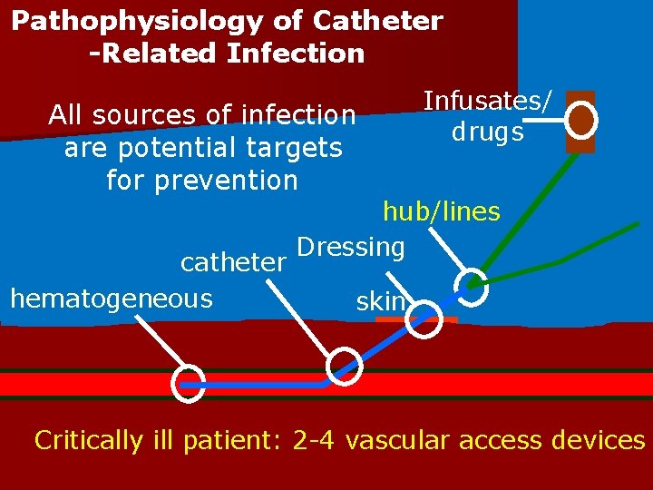Pathophysiology of Catheter Related Infection All sources of