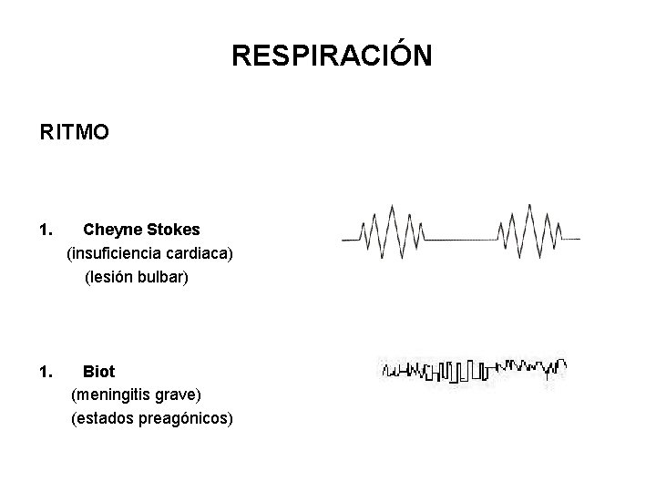 RESPIRACIÓN RITMO 1. Cheyne Stokes (insuficiencia cardiaca) (lesión bulbar) 1. Biot (meningitis grave) (estados