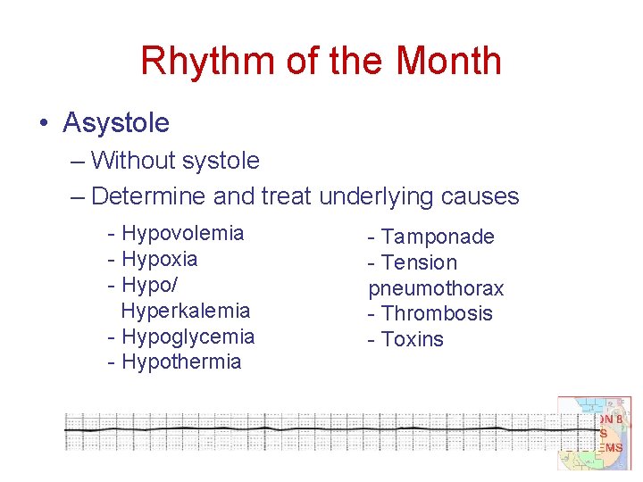 Rhythm of the Month • Asystole – Without systole – Determine and treat underlying