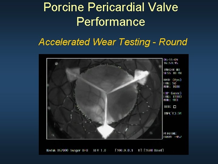 Porcine Pericardial Valve Performance Accelerated Wear Testing - Round 