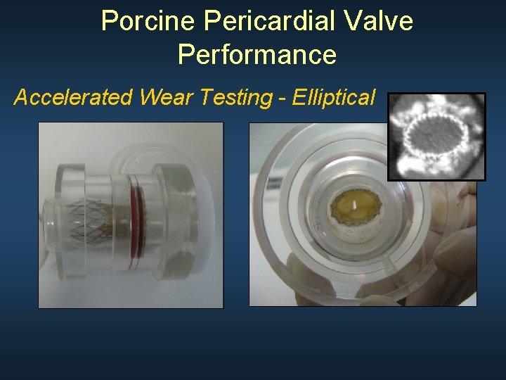 Porcine Pericardial Valve Performance Accelerated Wear Testing - Elliptical 