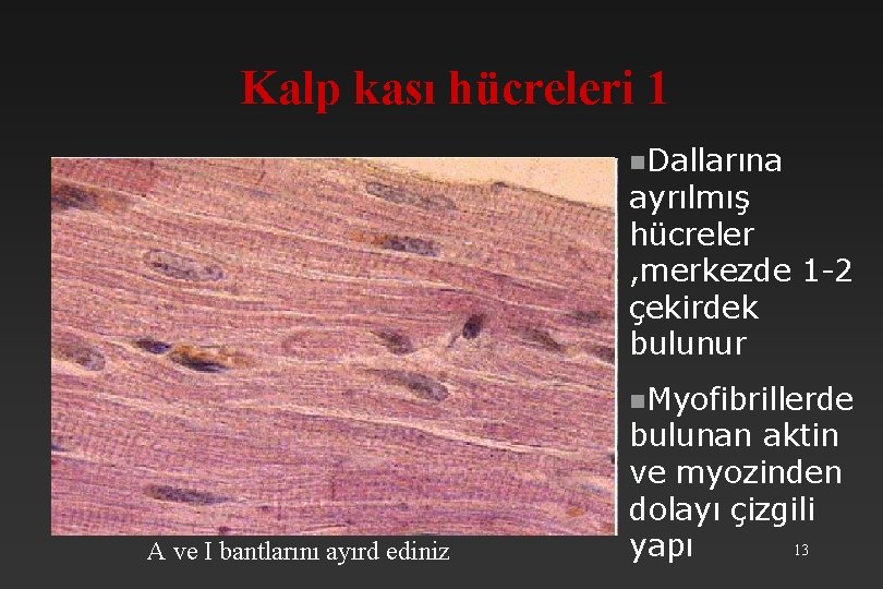 Kalp kası hücreleri 1 n. Dallarına ayrılmış hücreler , merkezde 1 -2 çekirdek bulunur