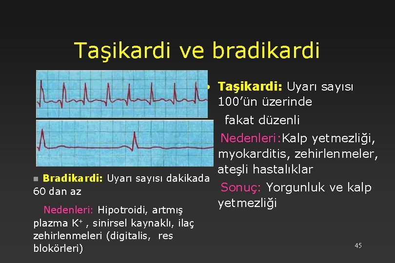 Taşikardi ve bradikardi • Taşikardi: Uyarı sayısı 100’ün üzerinde fakat düzenli Bradikardi: Uyarı sayısı