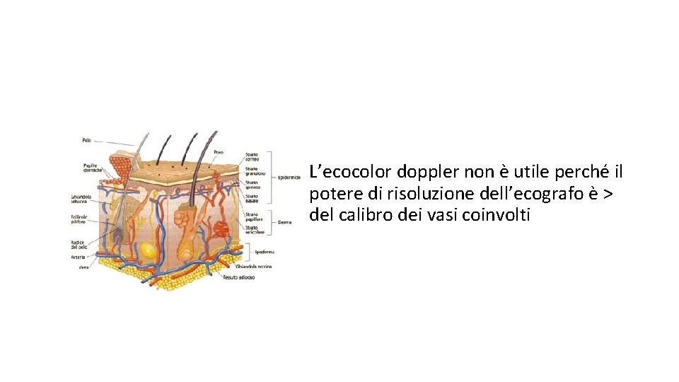 L’ecocolor doppler non è utile perché il potere di risoluzione dell’ecografo è > del