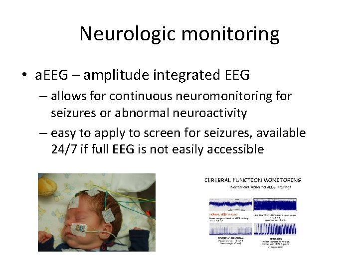 Neurologic monitoring • a. EEG – amplitude integrated EEG – allows for continuous neuromonitoring