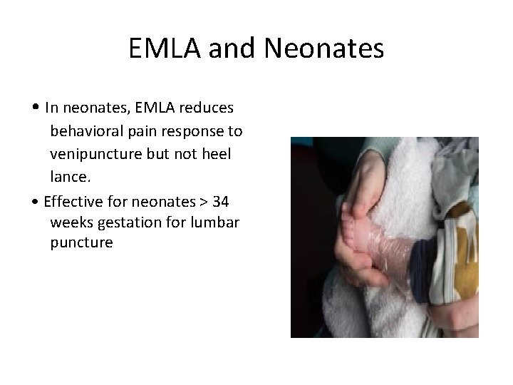 EMLA and Neonates • In neonates, EMLA reduces behavioral pain response to venipuncture but