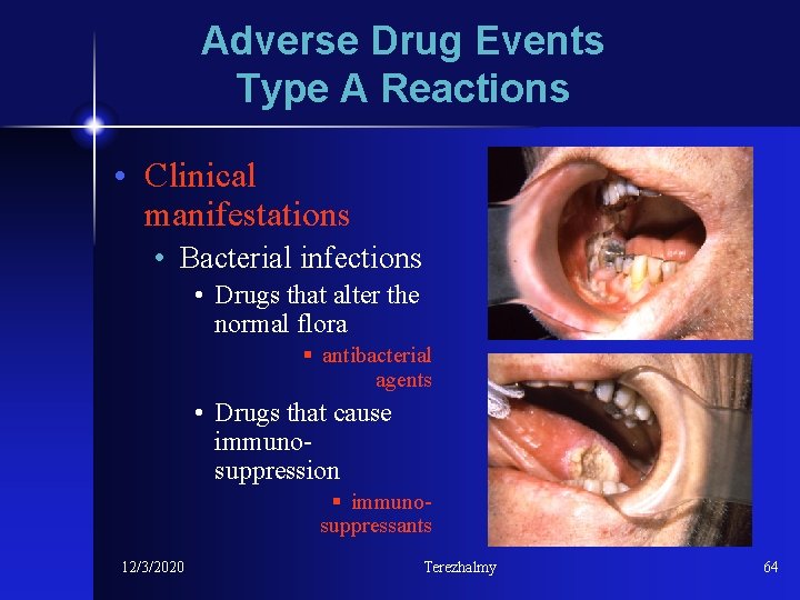 Adverse Drug Events Type A Reactions • Clinical manifestations • Bacterial infections • Drugs